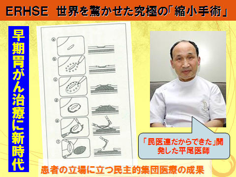 民医連だからできたと話す開発した平尾医師の画像